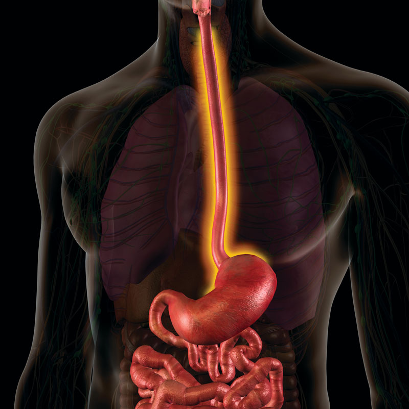 causes-symptoms-and-treatments-for-gastroesophageal-reflux